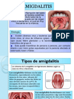 Amigdalitis, Faringitis, Parotiditis