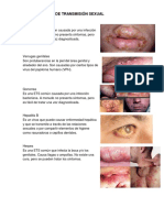 Enfermedades de Transmisión Sexual