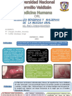 Mucosa Oral