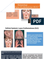 Systemic Lupus Erythematosus (SLE)