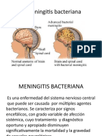 Meningitis Bacteriana