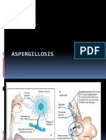 Aspergillosis