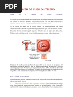 CÁNCER de Cuello Uterino