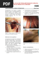 Laryngofissure Technique