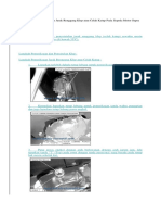 Pemeriksaan Dan Penyetelan Jarak Renggang Klep Atau Celah Katup Pada Sepeda Motor Supra