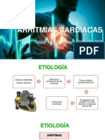 Arritmias Cardíacas