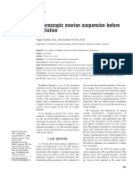 Laparoscopic Ovarian Suspension Before Irradiation