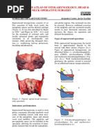 Open Access Atlas of Otolaryngology, Head & Neck Operative Surgery