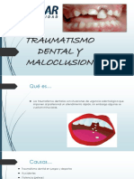 Trauma y Maloclusion