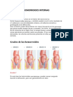 Hemorroides