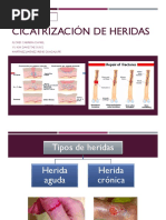 Cicatrización de Heridas