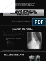 Acalasia, Primaria y Secundaria