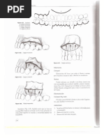 Odontosección