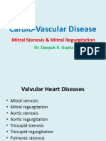 Cardio-Vascular Disease: Mitral Stenosis & Mitral Regurgitation