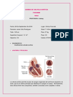 Cambio de Valvula Aortica 2