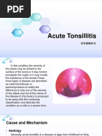 Acute Tonsillitis