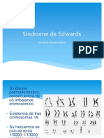 Síndrome de Edwards