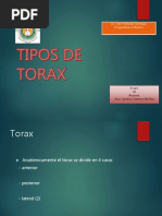 Tiposdetorax 160607062519