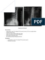 Lumbosacral AP