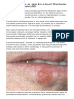 De Qué Forma Curar Las Llagas en La Boca O Aftas Bucales Con Propóleo de Manera Fácil