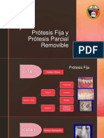 Protesis Fija y Removible