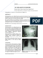 Isolated Case of Chilaiditi Syndrome