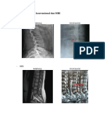 Gambar Radiologi Konvensional Dan MRI