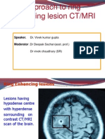 Ring Enhancing Lesions