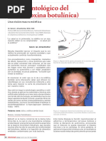 Uso Odontologico Del Botox Una Vision Macro Estetica