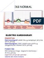 Budi EKG Normal