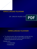 7 Hiperclaridad Pulmonar