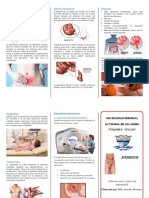 Apendicitis