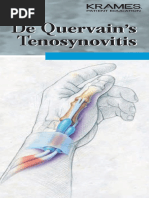 Dequervain's Syndrome