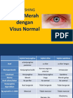 Mata Merah Visus Normal