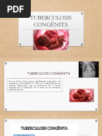 Tuberculosis Congénita 2