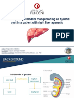 Retrohepatic Gallbladder Masquerading As Hydatid Cyst in A