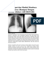 Cara Cepat Dan Mudah Membaca Foto Thorax