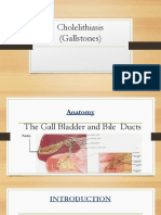 Cholelithiasis Gallstone