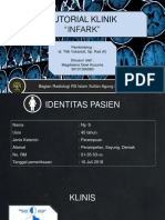 Tutorial Radiologi CT Scan Infark