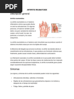 Artritis Reumatoide