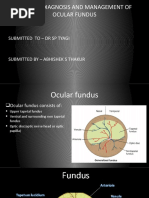 Diseases, Diagnosis and Management of Ocular Fundus