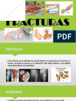 Fracturas