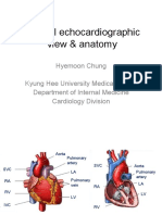 Normal Echocardiographic View & Anatomy