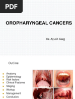 Oropharyngeal Cancers: Dr. Ayush Garg