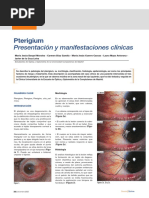 Klasifikasi Pterigium