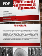 Copia de Principales Estudios y Procedimientos de Visualización