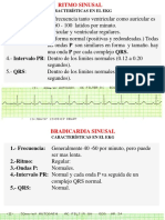 Electrocardiografia Basica