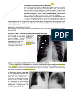 Resumo Radiologia Do Abdomên e Tórax