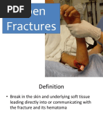 Management of Open Fractures