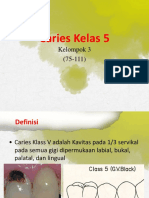 Caries Kelas 5